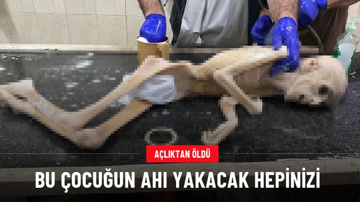 Gazze'de yeterli beslenemeyen 10 yaşındaki çocuk bir deri bir kemik halde öldü