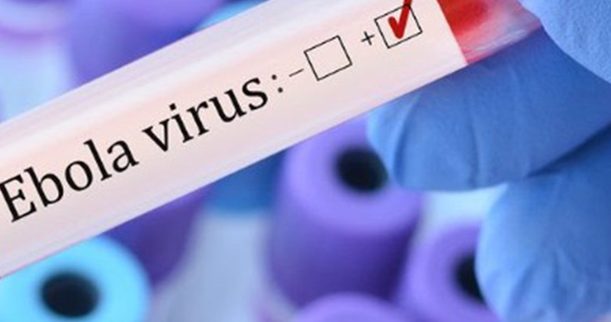 Ebola virüsü nedir,? Ebola virüsünün belirtileri neler?