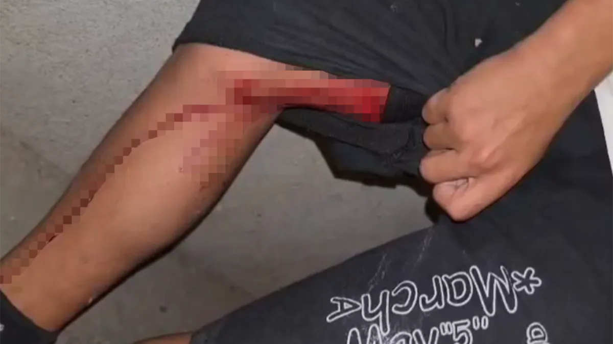 Diyarbakır'da maç kutlaması sırasında açılan ateş sonucu bir çocuk yaralandı